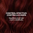 Shampoo anticaspa Anyeluz